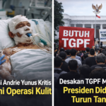 kondisi andrie yunus korban air keras kritis